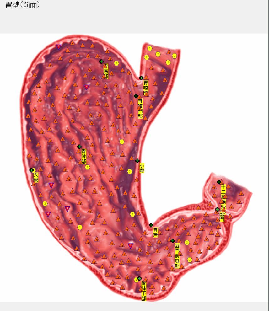胃壁マイクロ